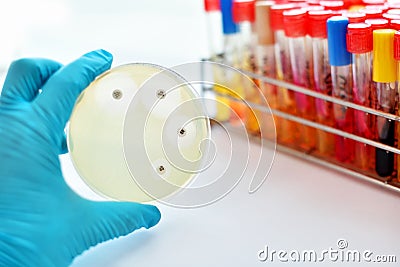 Antimicrobial susceptibility test Stock Photo