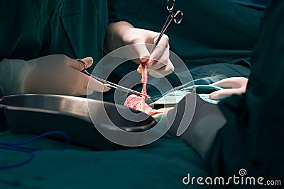 Appendectomy Stock Photo