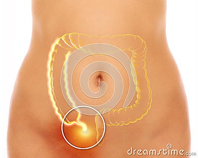 The appendix is a finger-like, blind-ended tube connected to the cecum. The cecum is a pouch-like structure of the colon Stock Photo