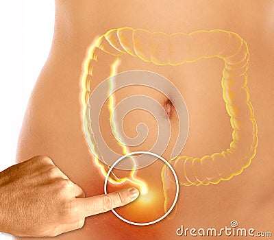 The appendix is a finger-like, blind-ended tube connected to the cecum. The cecum is a pouch-like structure of the colon Stock Photo