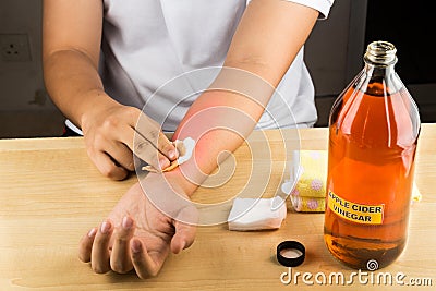 Apple cider vinegar effective natural remedy for skin itch, fung Stock Photo