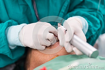 Apply laryngoscope blade for insert endotracheal tube Stock Photo