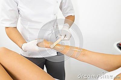 Applying a cooling gel to the hand before the laser hair removal procedure. Stock Photo