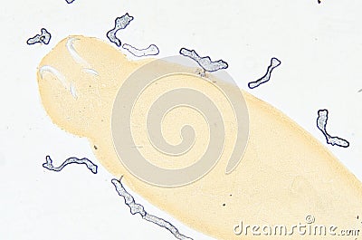 Aquaculture fish parasite Benedenia Stock Photo