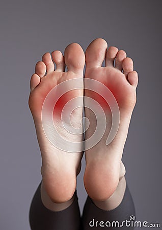 Arch pain, inflammation, overuse, plantar fascia injury. Foot with red points Stock Photo