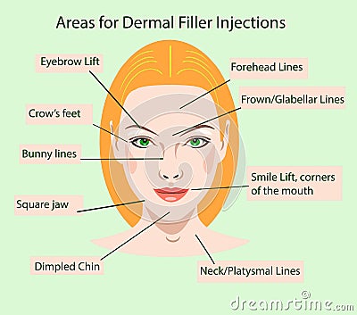 Areas for rejuvenation cosmetological injections Vector Illustration