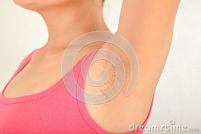 Hairy armpits and Black spots Stock Photo