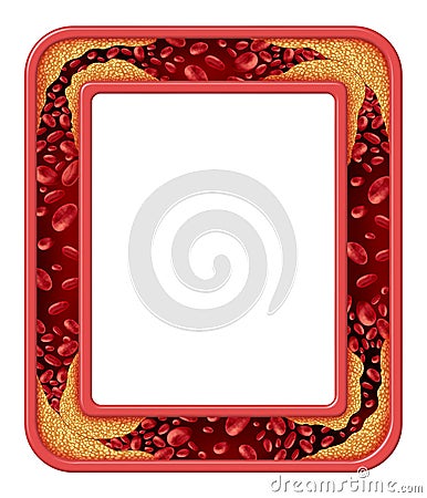 Artery Disease Frame Stock Photo