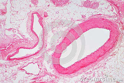 Artery vascular cross section under the light microscope view Stock Photo