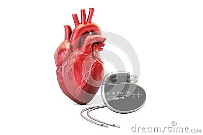 Artificial cardiac pacemaker, 3D rendering Stock Photo