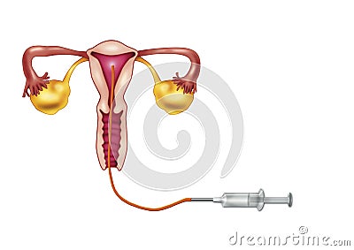 Artificial insemination Cartoon Illustration