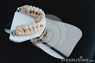 Artificial jaw with zirconium crowns, stands on a surgical mirror in a dental office. Dentistry and treatment concept Stock Photo