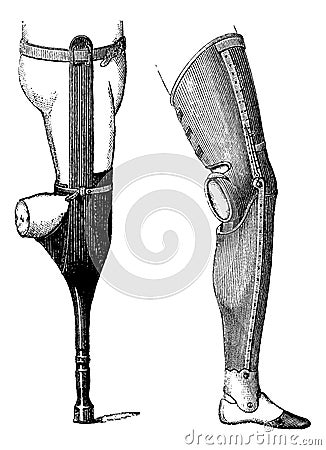 Artificial Legs for Below-knee Amputation, vintage engraving Vector Illustration