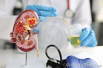 Artificial model of kidney and ureter of human standing on table of urologist doctor with urine test closeup Stock Photo