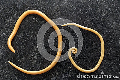 Ascariasis is a disease caused by the parasitic roundworm Ascaris lumbricoides for education. Stock Photo