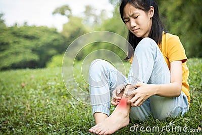 Asian child girl scratching itch on her leg with hand,female teenage with red rash,mosquito bite,fungal infection,insect bites, Stock Photo