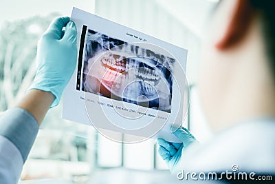 Asian male dentists are analyzing x-ray images of patients at th Stock Photo
