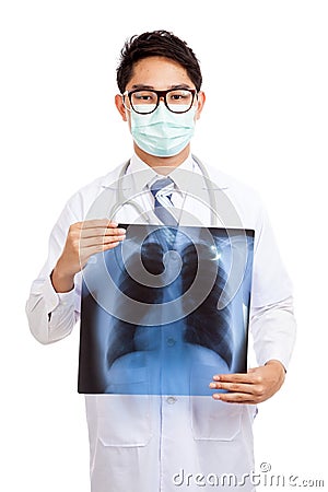 Asian male doctor wear mask with lung x-ray film Stock Photo