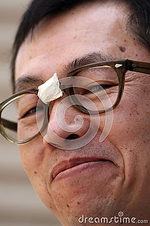 Asian Man in Broken Glasses Stock Photo