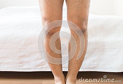 Asian man leg bandy-legged shape of the legs Stock Photo