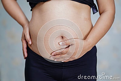 Asian middle-aged lady woman patient touch and feel pain her stomach Stock Photo