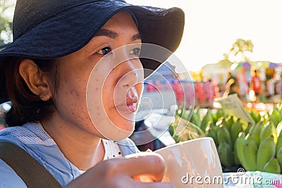 Asian woman drinking supplementary food beverage facial acne and Stock Photo