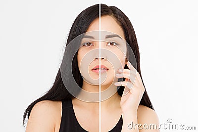 Before after asian woman face closeup isolated on white background. Before-after skin dark circles under eyes. Face care and Stock Photo