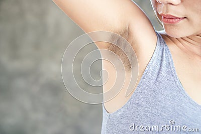 Asian woman having problem fat skin underarm and black armpit Stock Photo