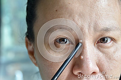 Asian woman point mole on her face and nose Stock Photo