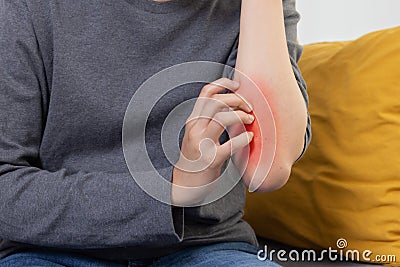 Woman Scratching her Arm Suffer from Allergy Itchy Skin Stock Photo