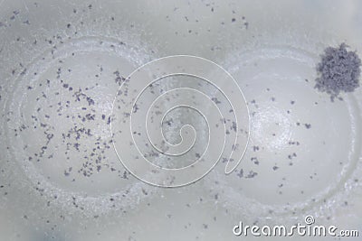 Aspergillus mold and yeast for Microbiology. Stock Photo