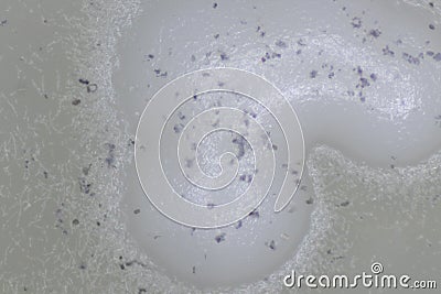 Aspergillus mold and yeast for Microbiology. Stock Photo