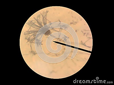 Aspergillus niger, common species of the genus Aspergillus found in the air and sewage of landfill, using microscope to isolated. Stock Photo