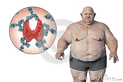Autoimmune thyroiditis in obesity, conceptual 3D illustration showing an overweight patient and thyroid gland attacked by Cartoon Illustration