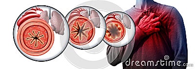 Asthma And Chest Pain Cartoon Illustration