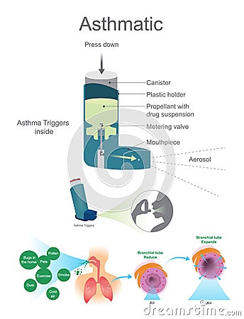 Asthmatic. Stock Photo