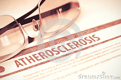 Atherosclerosis. Medicine. 3D Illustration. Stock Photo