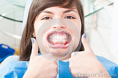 Attractive female patient wearing retractor and thumb up Stock Photo