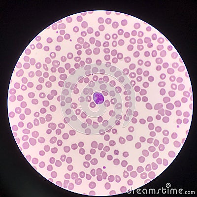 Atypical lymphocyte on red blood cells background Stock Photo