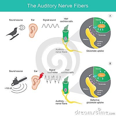 The auditory nerve fibres, comparison sound source 2 types which it is sent the signal sound Vector Illustration