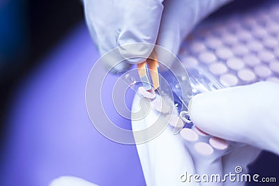 Auriculartherapy ear seed treatment Stock Photo