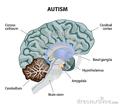 Autism Vector Illustration