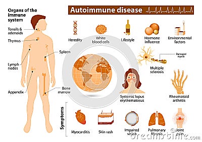 Autoimmune disease infographic Vector Illustration