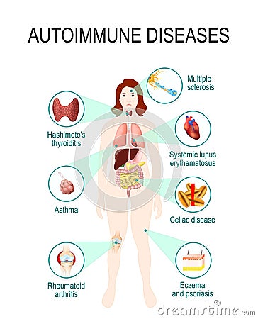 Autoimmune diseases Vector Illustration