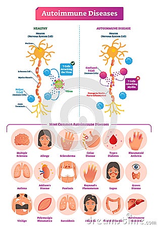 Autoimmune diseases vector illustration. Various illness collection set. Vector Illustration