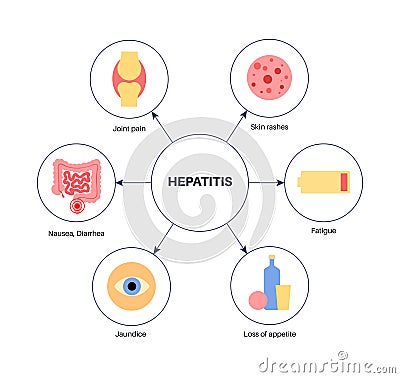 Autoimmune hepatitis disease Vector Illustration