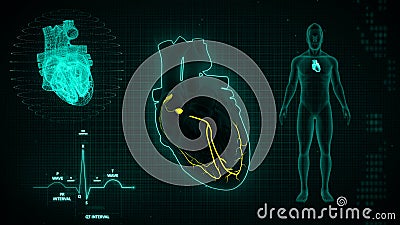 AV and SA Node Signals or Atrioventricular and Sinoartial Node Signal of Human Heart Stock Photo