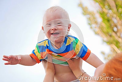 Baby with Down syndrome Stock Photo