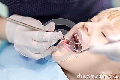 Baby girl visiting stomatology clinic. Dentist making checkup of kids teeth. Children tooth and mouth healthcare Stock Photo