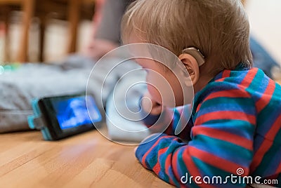 Baby with hearing aid Stock Photo